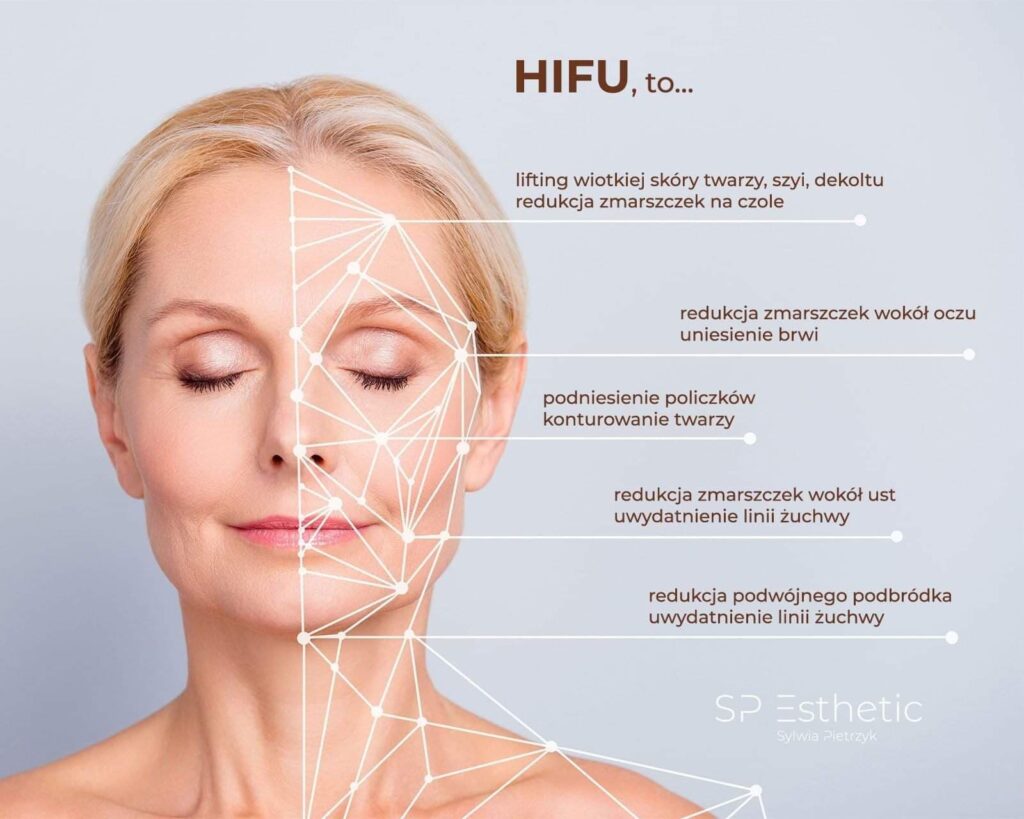 HIFU lifting twarzy